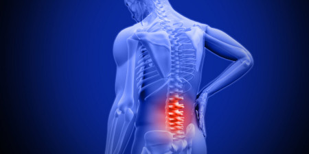 Lower Back Pain Lower Back Pain
